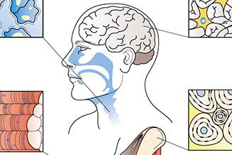 Как физические нагрузки влияют на артроз коленного сустава